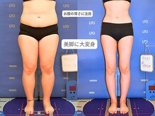 ピュアノア 垂水店/痩身ダイエット　神戸垂水明石