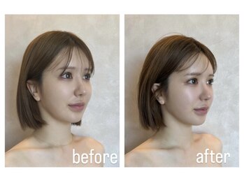 ナルシス(Narcissus)/インディバフェイシャル