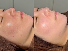 ルーナジェーナ(Luna llena)/