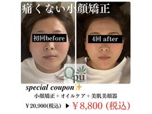 キュープ 奈良天理店(Qpu)