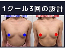 セブンシーズ 上野店(Seven Seas)/バストアップ/豊胸/東京都/上野