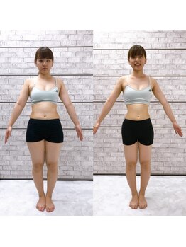 イーストレッチジム 新宿(E-STRETCH GYM)/ビフォーアフター