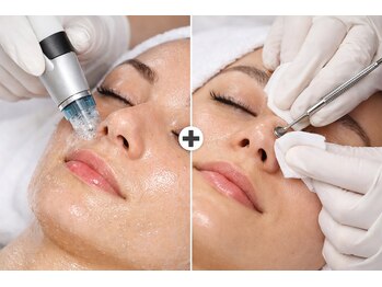 ピエル 柏店(PIEL)の写真/【水流の力で毛穴の奥までごっそり吸引洗浄】諦めていた毛穴汚れやざらつきに徹底アプローチし透明感UP！
