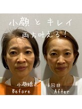 ニコ(NICO)/お客さまのビフォーアフター