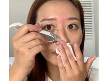 セルフダック いわき平店(SELFDUCK)/◇ハイドラ毛穴洗浄、保湿