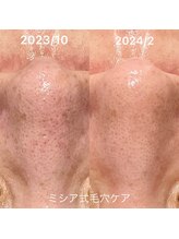 ルココン エミュ(le cocon e'mue)/ミシア式毛穴ケア