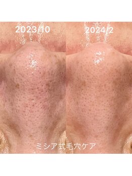 ルココン エミュ(le cocon e'mue)/ミシア式毛穴ケア