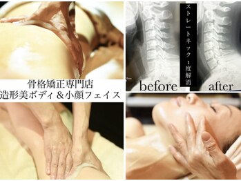 ビチル 薬院(美chill)/骨格矯正・痩身