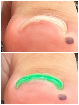 巻き爪/フットネイル/ワンカラー