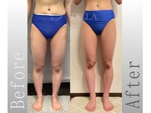 ステラ(STELLA)/下半身プレミアムの効果