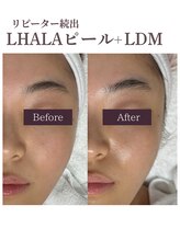 フォルディオ(FORDIO)/ララピールx水玉リフティング