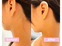 銀座八/見られてる！うなじケア必須