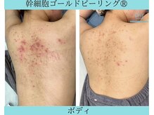 リメイククリニカルビューティー(Remake clinical beauty)/