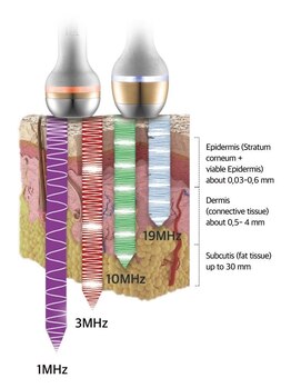 スリースターズ(☆☆☆STARS)/