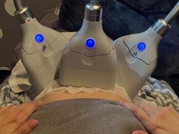 ジュノプラス 諫早店(JUNO+)の写真/最先端技術!脂肪冷却マシン導入!ダイエットで挫折してきた方も効果を実感♪限定30名☆1カップ6800円◎