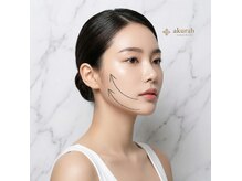 アクラフ 北千住(akurah)の雰囲気（マイクロリフトで輪郭スッキリ！小顔実感！ アクラフ/北千住）