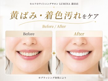 ルミナ 蒲田店(LUMINA)の写真/コーヒー・紅茶による黄ばみを集中ケア。歯本来の自然な明るさへ！