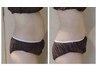【強力セル脂肪分解】ぽっこりお腹を撃退!90分¥19800→¥4500
