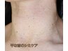 【首シミケア専用】集中ケア15分し放題※ヘッドマッサージ付◎8800円→5500円