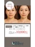 【7 月限定】夏特有の毛穴悩みへ ダウンタイムなしハーブピーリング　¥10,000