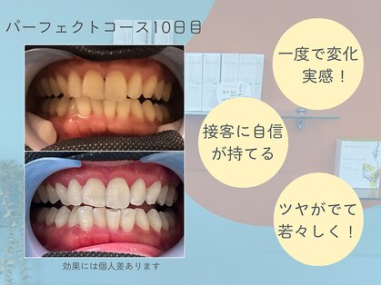 ハモットホワイト(Hamotto White)の写真