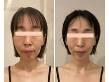 ドクターボディクリスタル(Dr.Body Crystal)/50代　