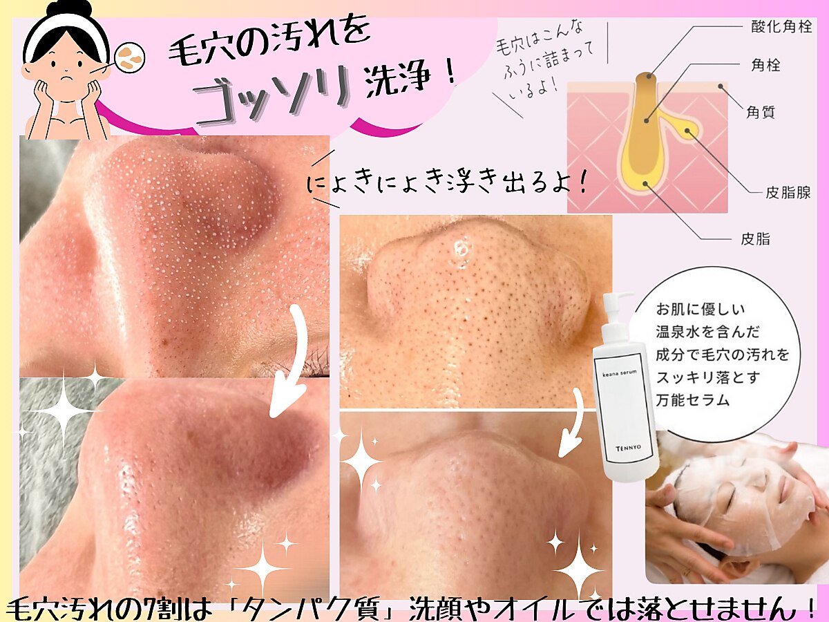 オンユ(ON'U)｜ホットペッパービューティー