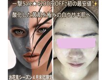 アルページュ(Arpege)の雰囲気（極み！純白肌は宝石スピア白雪タラソの上級ver★ジュエルタラソ）