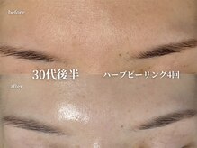 コウル 川西能勢口店(geoul)/透明感アップコース