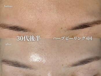 コウル 川西能勢口店(geoul)/透明感アップコース