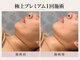 トリプルサンショップ 京都店の写真/【京都/四条】シミ・くすみ・しわが気になる大人肌へ。透明感とハリ・ツヤを引き出す集中フェイシャル