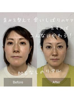 ニコ(NICO)/お客さまのビフォーアフター