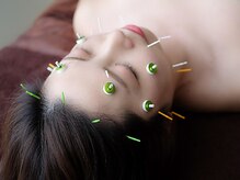 サラン鍼灸院(SARAN都楽鍼灸院)/美容鍼灸