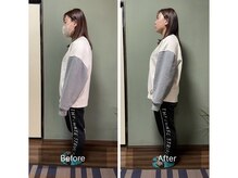 ミントのかべの整体院/姿勢矯正ビフォーアフター