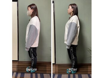 ミントのかべの整体院/姿勢矯正ビフォーアフター