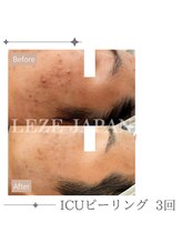 フロート(float)/