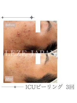 フロート(float)/