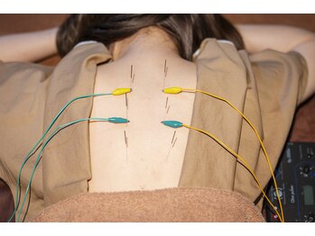 カラダキュア 東京銀座/身体の電気鍼