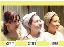 アン 銀座(ann)/美人度UP!!