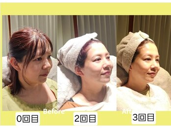 アン 銀座(ann)/美人度UP!!