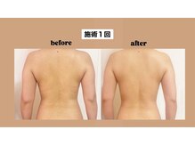 カオク ビューティーサロン(kaoku beauty salon)の雰囲気（ダイエットをされている方へ！痩身コース多数）