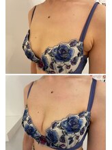 美人バスト 柏店/【バストアップ・育乳】症例