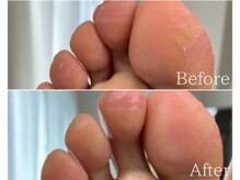 カシェット 広島店(Cachette)/50代女性☆足裏角質ケア90分