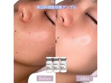 ソアン(Soin)/エステダーマ