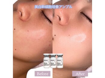 ソアン(Soin)/エステダーマ