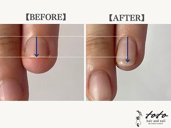トトヘアー アンド ネイル(toto hair and nail)/【toto式】自爪育成ネイルケア