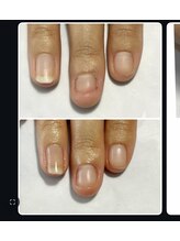 ミオンネイル(mion nail)/育成ネイル