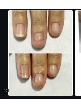ミオンネイル(mion nail)/育成ネイル