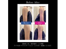 エラ(Ella)の雰囲気（二の腕・デコルテに特化した痩身メニューもございます！）