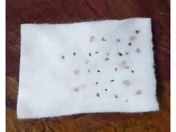 エイジレススパ ハクタ 西宮店/しみを改善できるコース